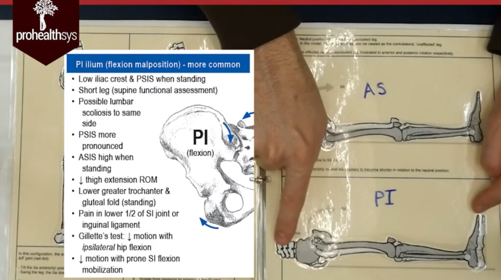 SI Motion Long Sit Test Anterior Posterior Pelvic Tilt Dr Vizniak